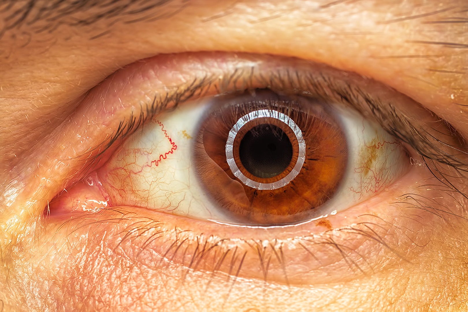 Ta boljše Oko - The good Eye by Emil B