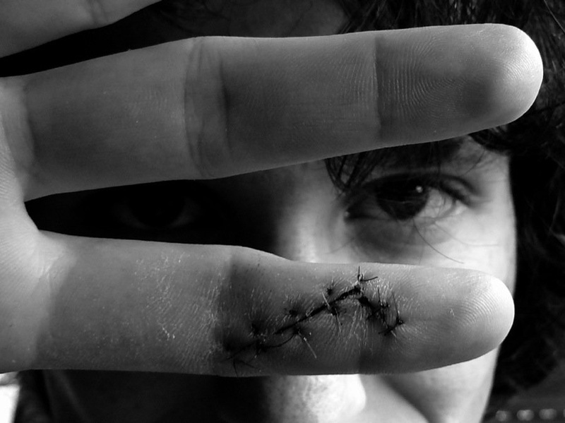 bad finger by Mitja Guzelj