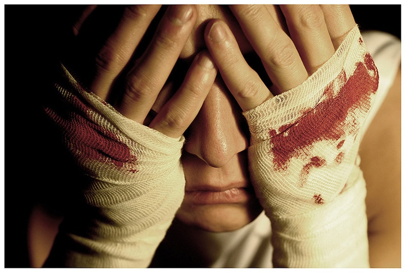 Hurt by Miha Skulj