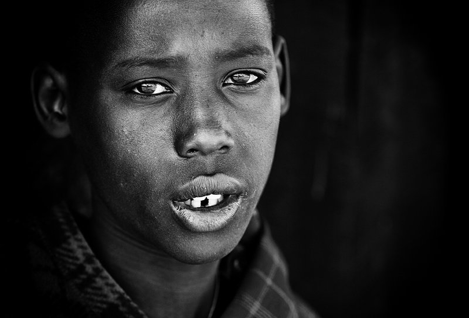 Broken tooth by Goran Jovic
